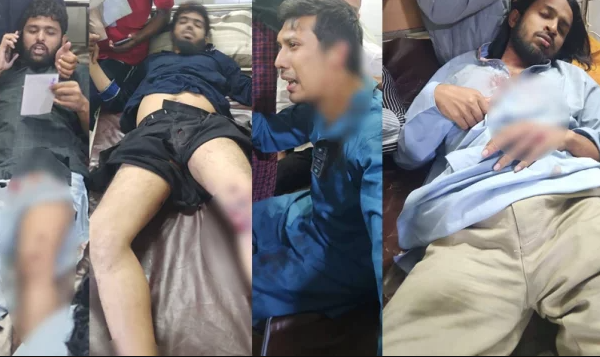 ইনকিলাব মঞ্চের নেতা-কর্মীদের সঙ্গে পুলিশের সংঘর্ষ, আহত জাবের